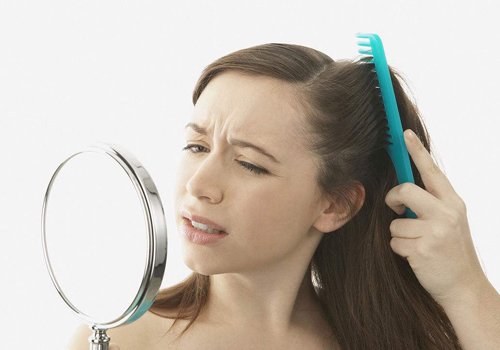 90后的你已经脱发了吗,90后脱发报告