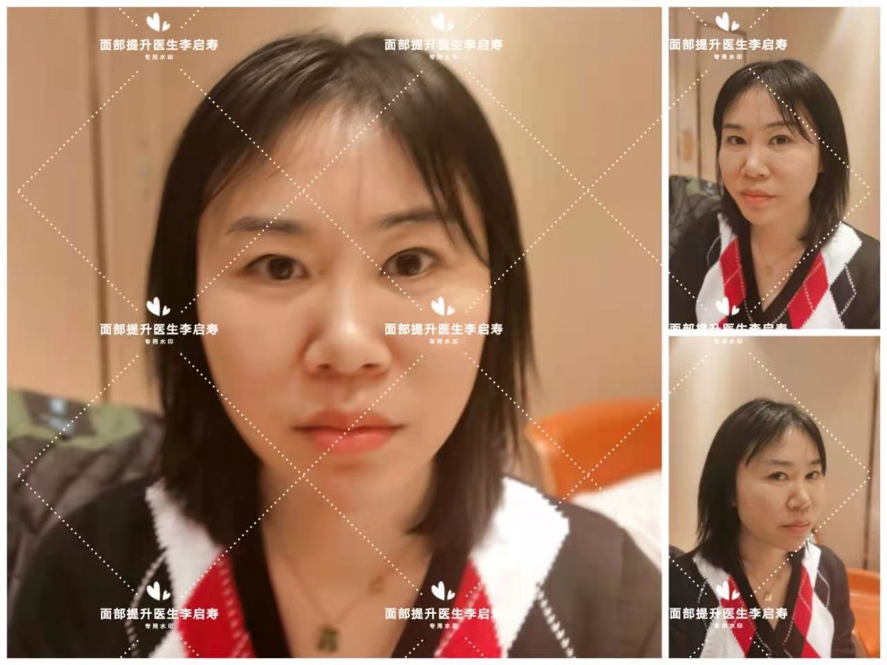 长脸型怎么美颜好看,长脸型怎么让脸胖点