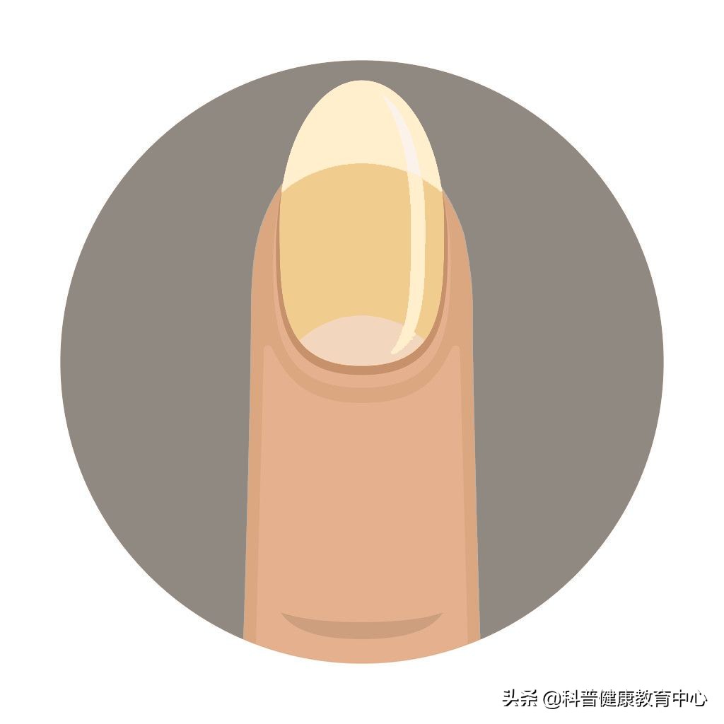 手相的科学解释,从医学角度解读手相的秘密