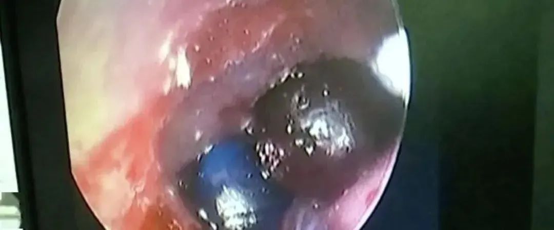 最危险的玩具弹珠,吸水球玩具危险