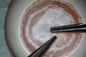 鸡蛋皮缝合手术,缝合鸡蛋膜视频教程