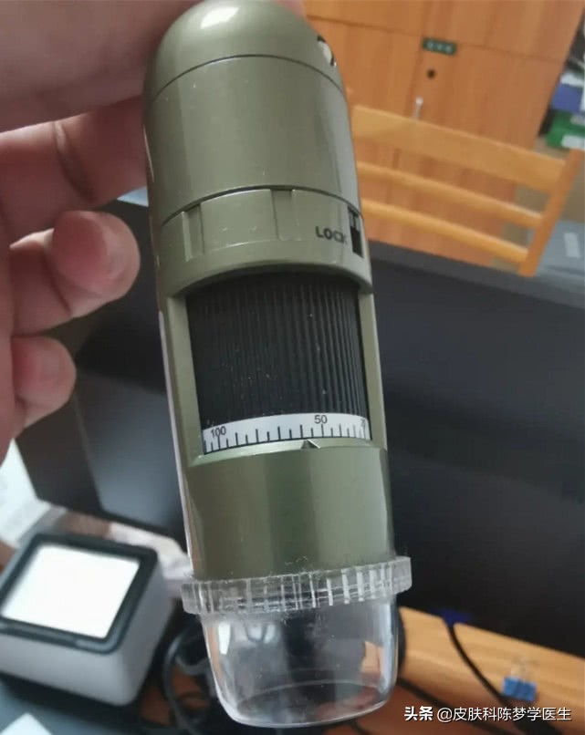 脸上长很多痣是好还是坏,脸上痣发炎红肿是癌变吗