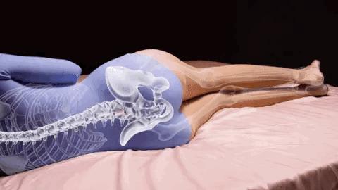 腰椎间盘突出小针刀后躺多久,腰椎间盘突出怎么躺比较好