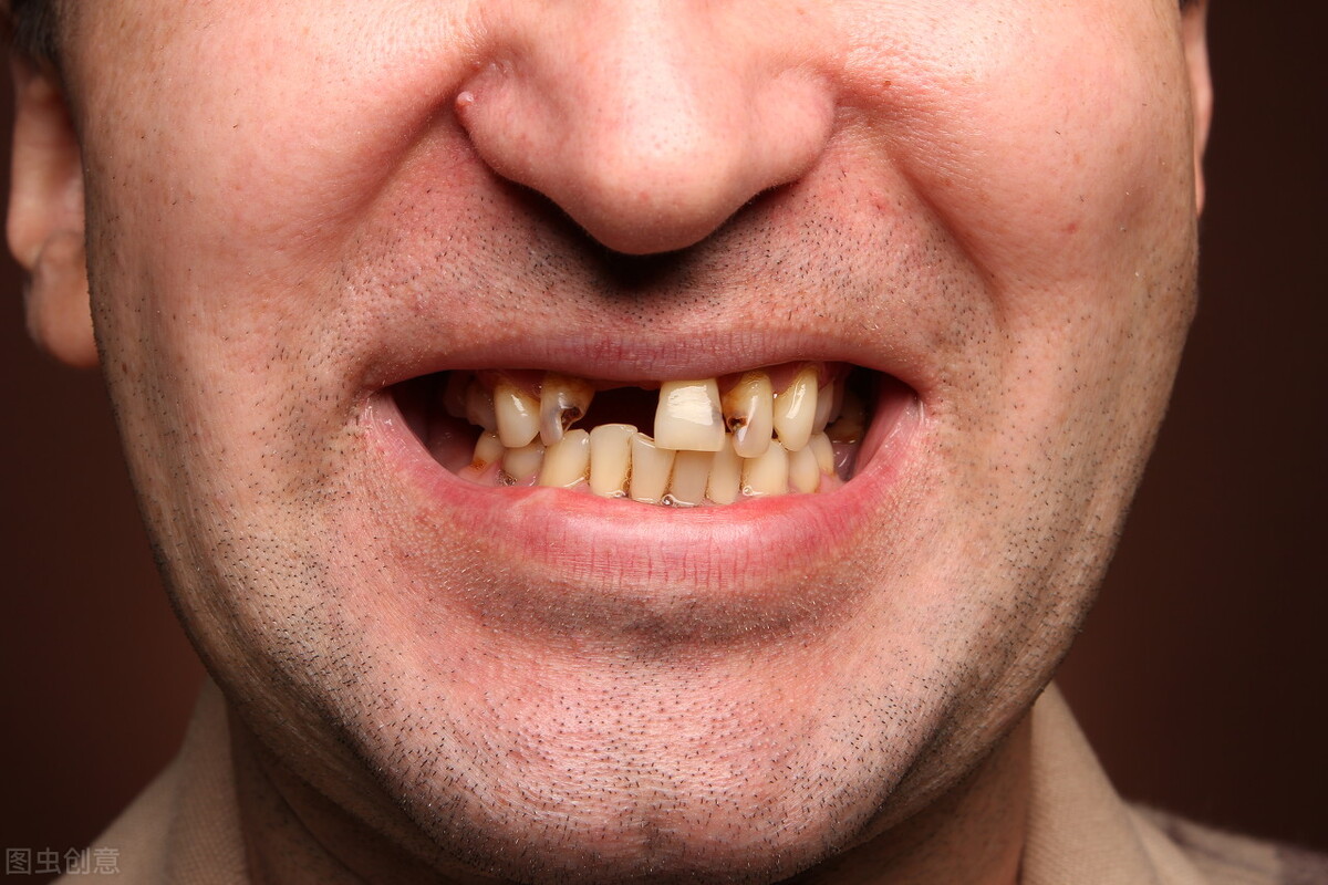 槟榔的危害这么大为什么还有人吃,槟榔有害为什么还那么多人吃