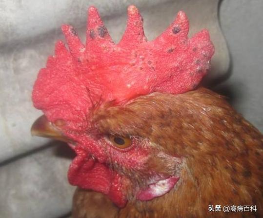 鸡冠长痘怎么治疗效果最好,鸡冠长痘怎么治视频