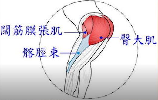 髂胫束摩擦综合征为什么不能下蹲,膝关节外侧髂胫束疼痛症状