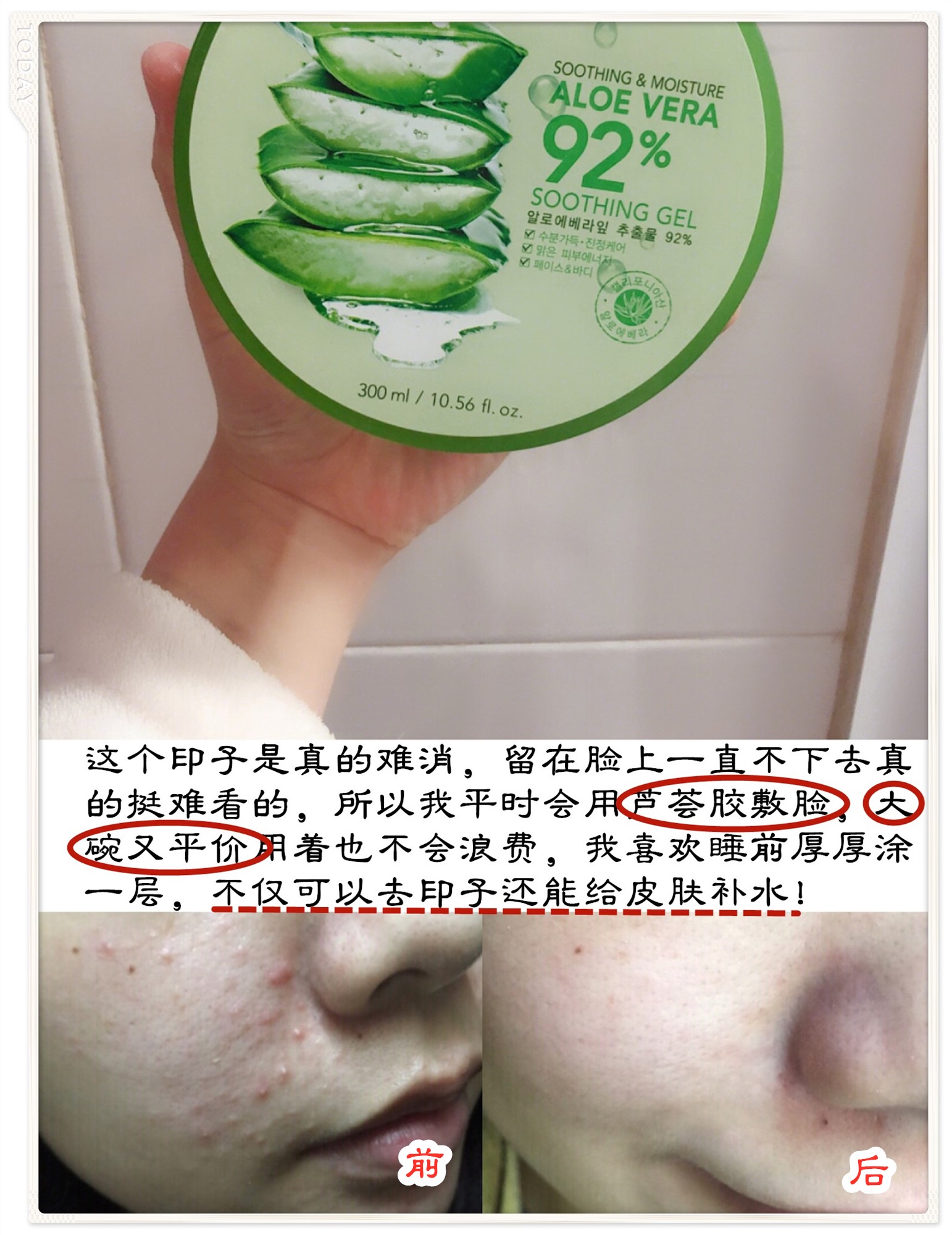 别爱我没结果，除非皮肤好过我，去黑眼圈细纹逆袭漫画眼