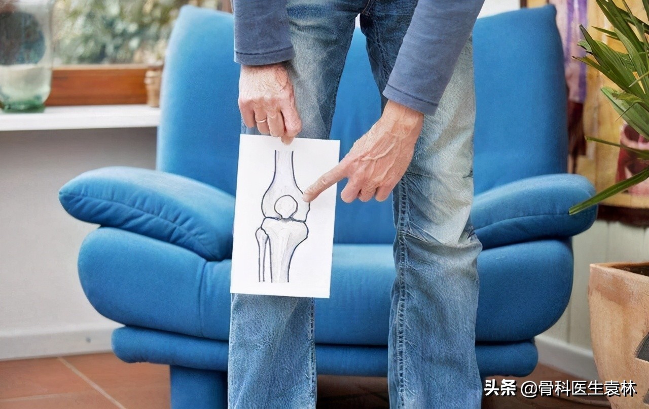 左肩关节冈上肌肌腱损伤关节积液,关节炎有积液怎么治疗最好最有效