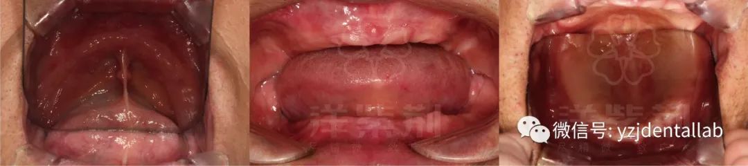 病例教学视频,病例分析操作技能