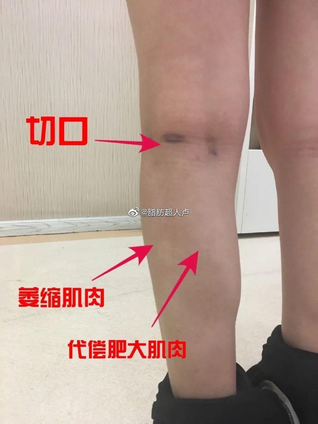 直接看呆，谁能拦住这不要命的“美”人