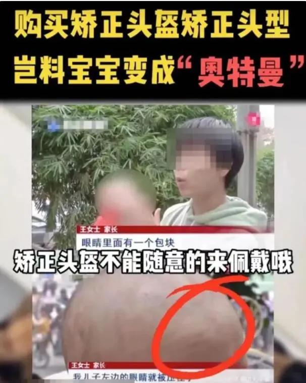 一岁宝宝睡偏头戴婴儿矫正头盔,七个月宝宝戴头盔多久能纠正头型