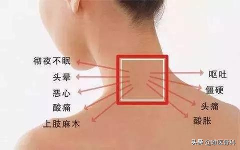 颈椎病10种保守治疗方法建议转载,严重的颈椎病如何保守治疗