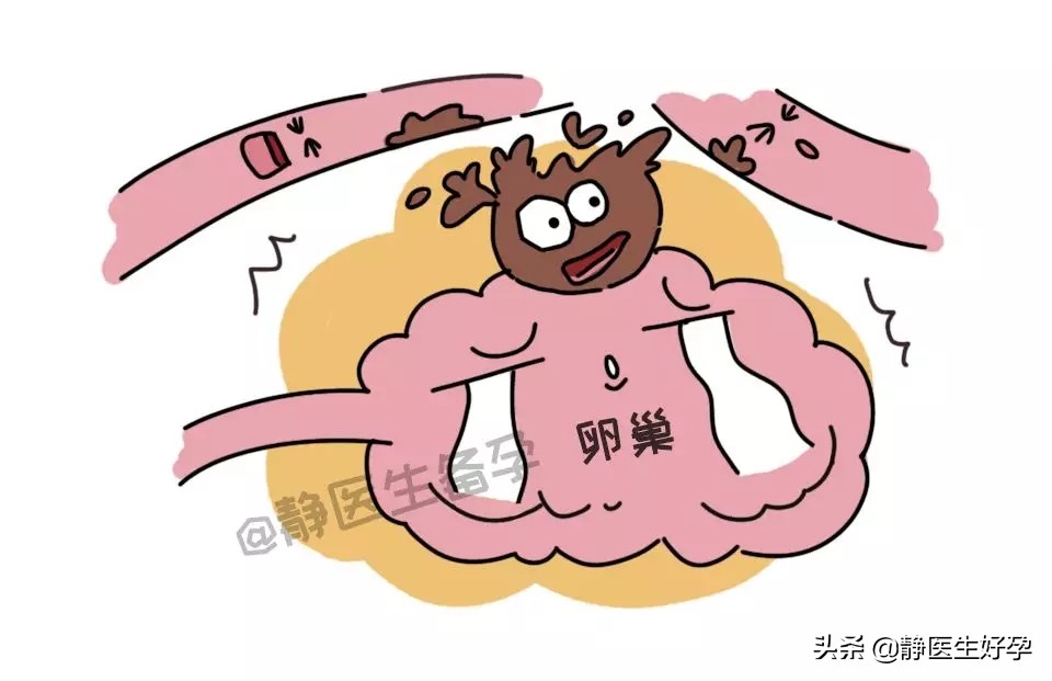 巧克力囊肿想备孕应该怎样做,备孕有巧克力囊肿可以喝豆浆吗