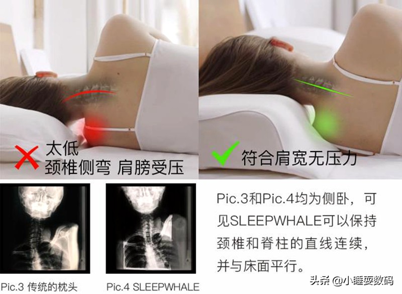 有颈椎病适合用什么类型的枕头,最好的保护颈椎的专用枕头推荐