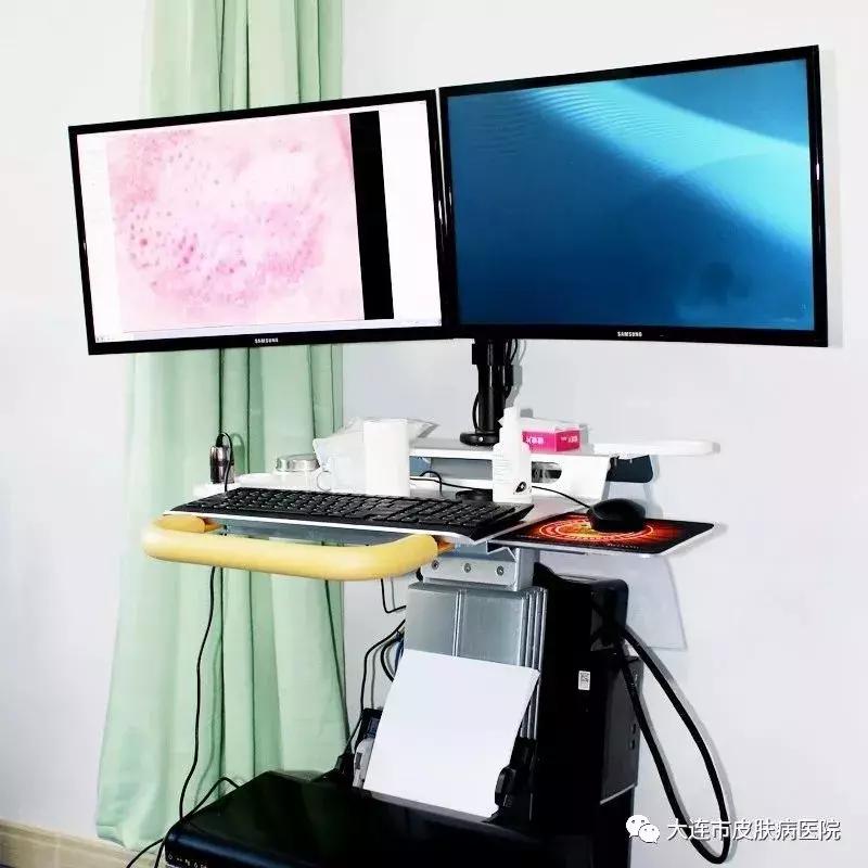 原来整个黑痣变成多个小黑痣,大腿长了一个一个小黑点