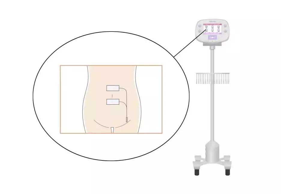 做到这5点一个月必减十斤,做到这五点让你越来越瘦