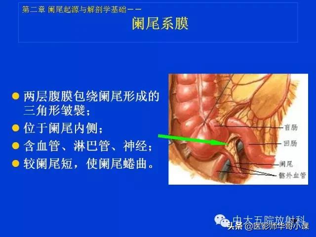 阑尾炎课件,阑尾炎的超声课件
