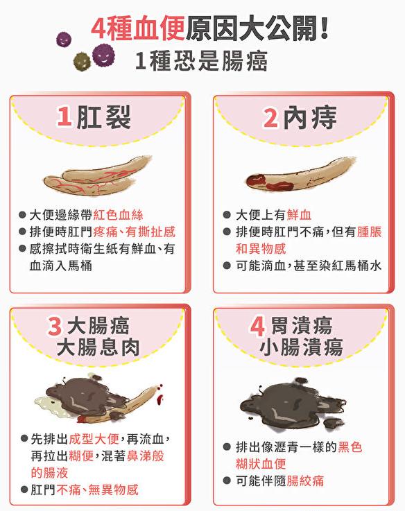 大便出血警惕6种病癌症,大便隐血是大肠癌吗