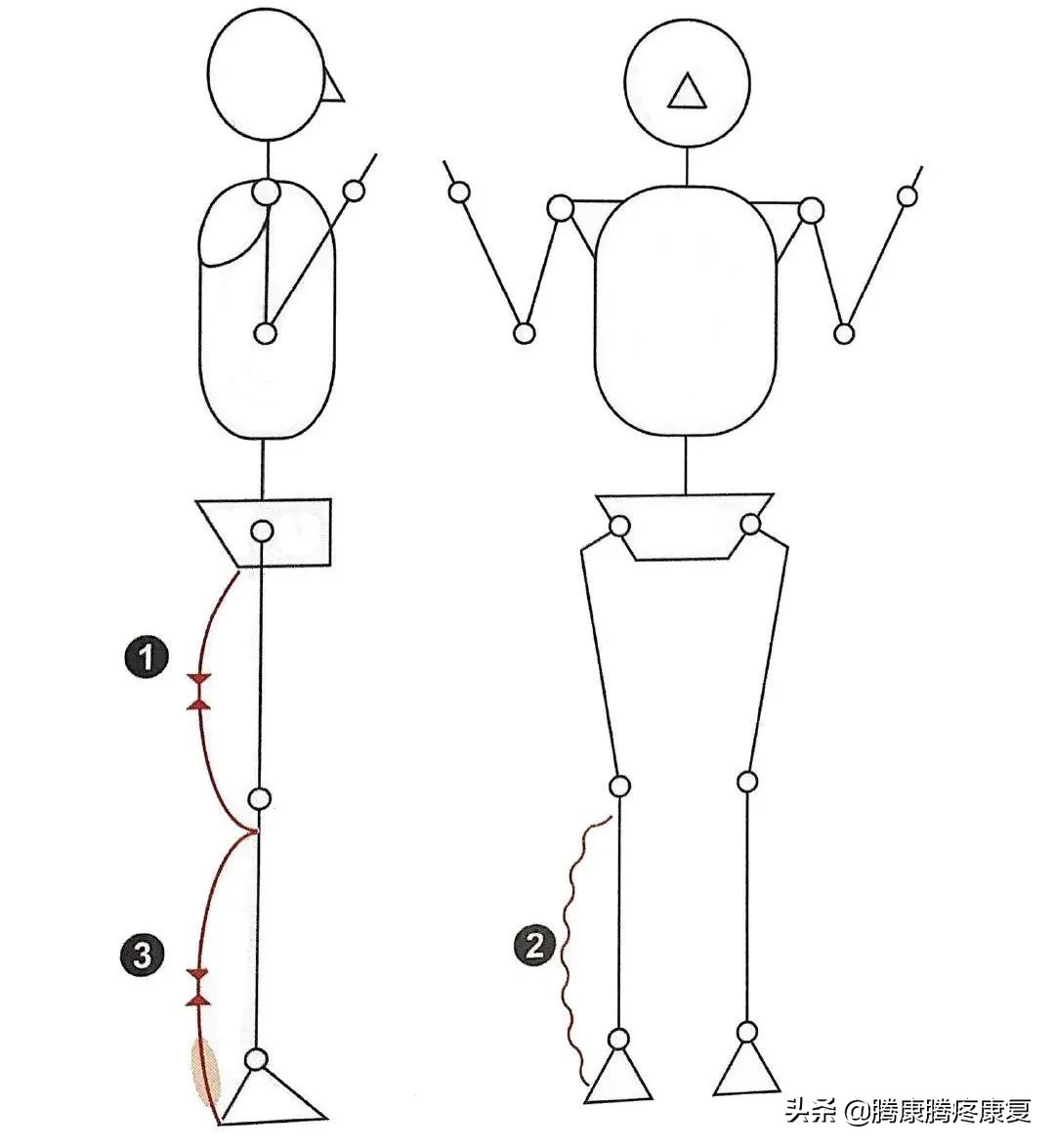 跟腱炎临床诊疗指南,跟腱炎起因和治疗