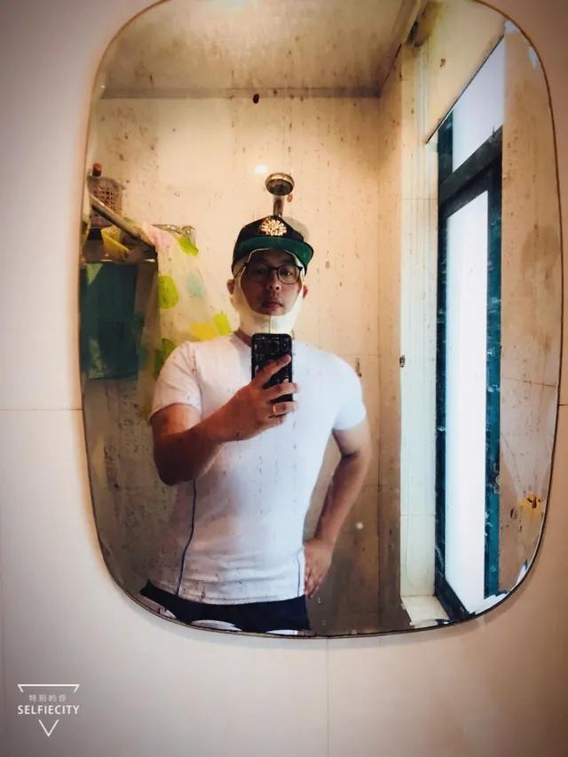 抽脂亲身经历回忆,抽脂血泪史