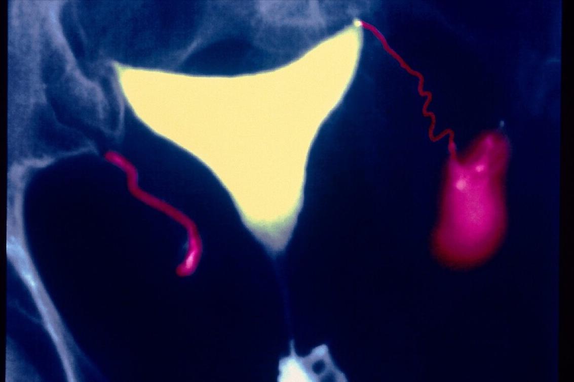 每个医院试管成功率由谁统计的,试管婴儿成功率视频