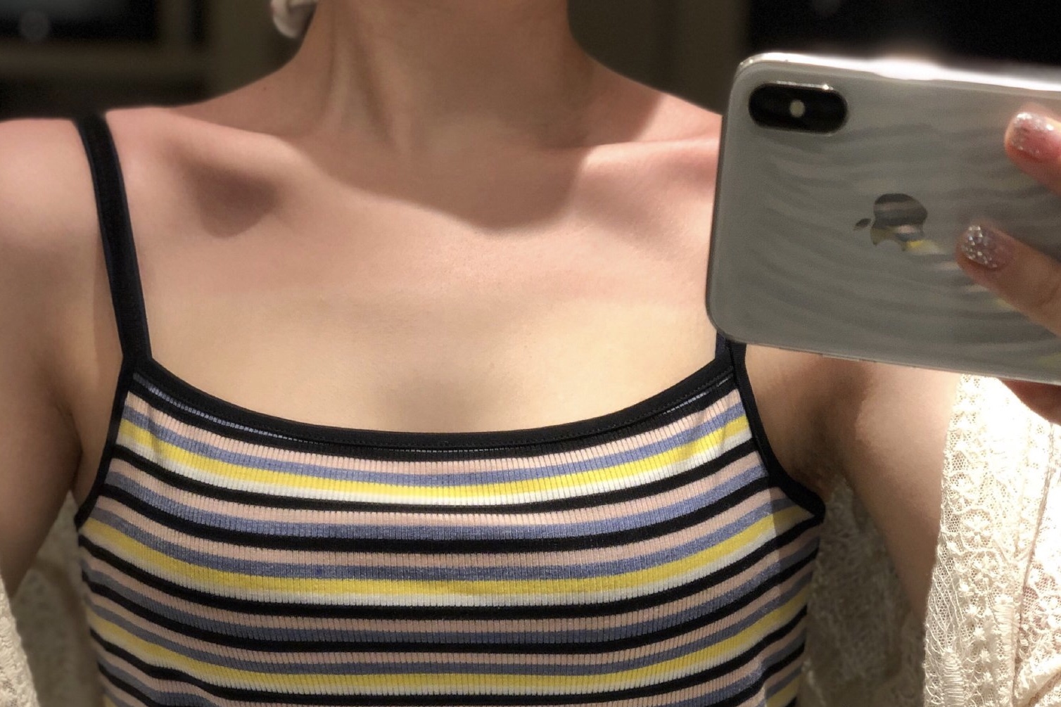 羽绒服被太阳晒变颜色如何修复,晒后修复在家怎么做