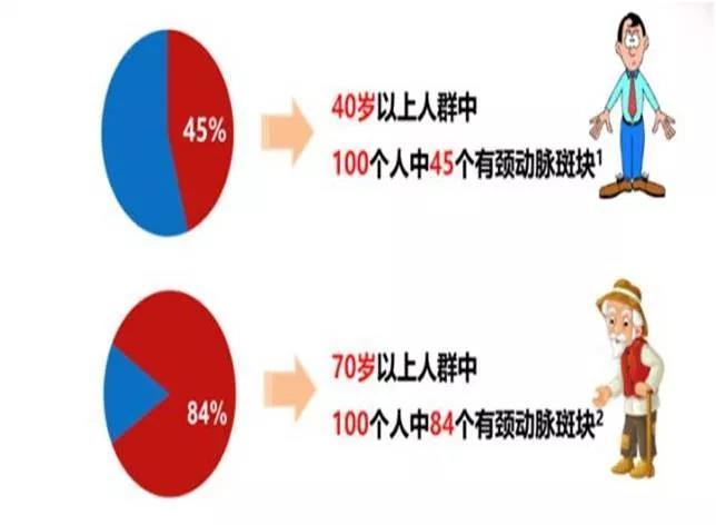 查颈动脉斑块挂什么科,颈动脉斑块的治疗方法