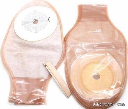 直肠癌手术结肠造口还是回肠造口,直肠癌造口后还需要做肠镜