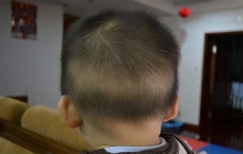 宝宝缺钙不得了怎么补钙吸收好,宝宝缺钙怎么办才能补得快