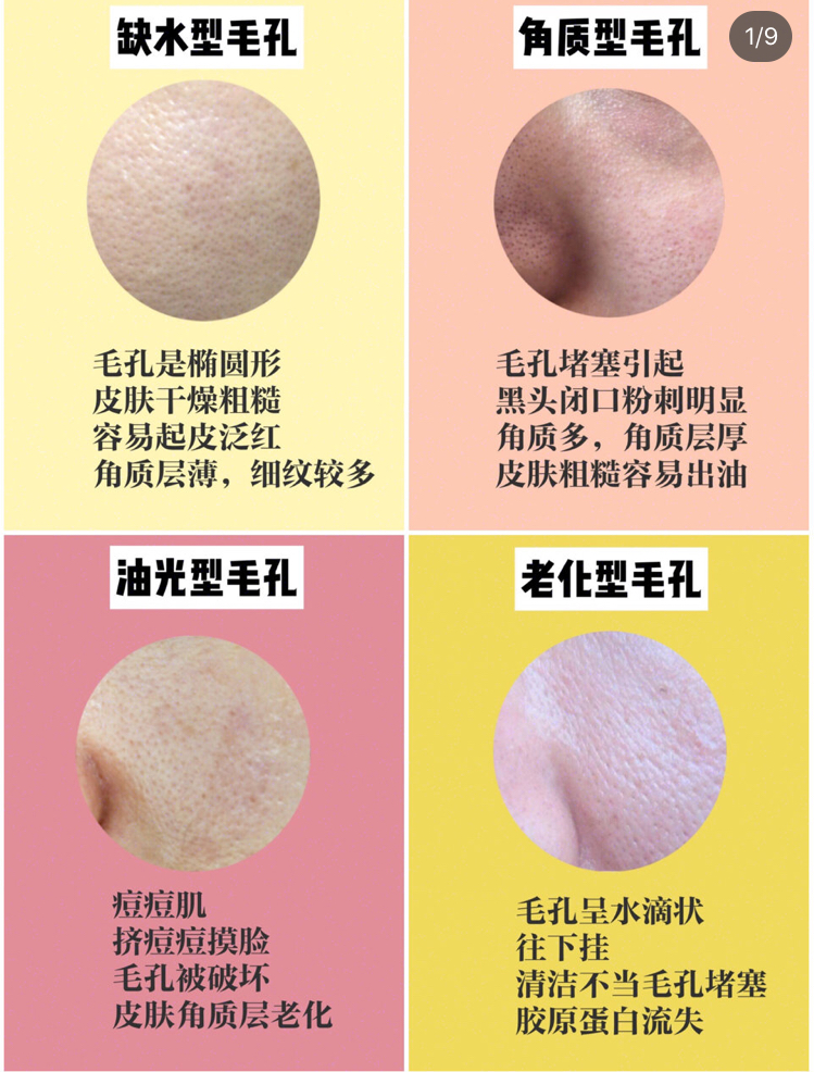 毛孔粗大黑头用什么类型的护肤品,毛孔粗大用什么类型面膜