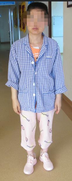 脑出血后脑积水会造成意识不清吗,脑出血后脑积水发高烧危险期多久