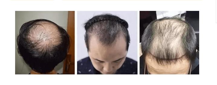 假发超稳固怎么佩戴,假发片怎么戴才没有痕迹