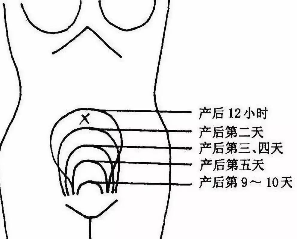产后子宫复旧不全的诊断,产后多久可以做子宫复旧