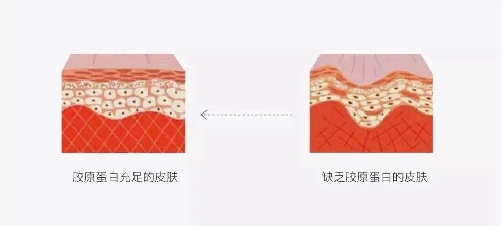 年纪轻轻脸就“崩了”？到底是哪里没做好