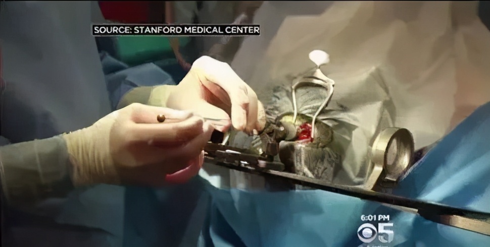 自体造血干细胞能治疗什么病,干细胞治疗脑卒中医院