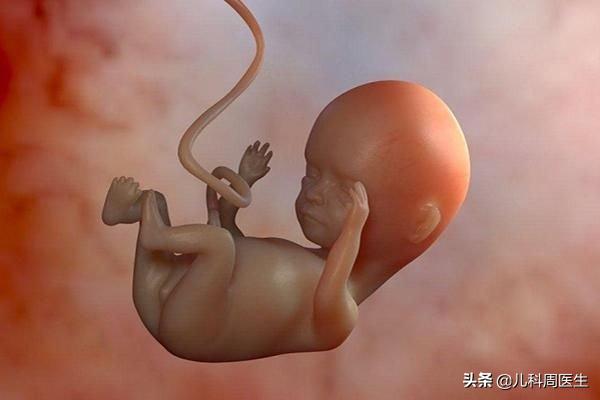 胎儿脐绕颈一周会自己绕回来吗,胎儿绕脐带3圈怎么办