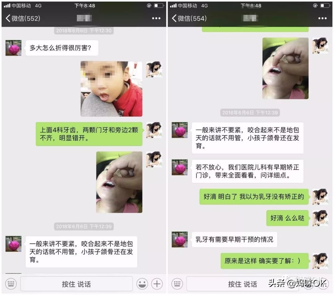 预防乳牙不齐的方法,牙不齐需要乳牙期干预么