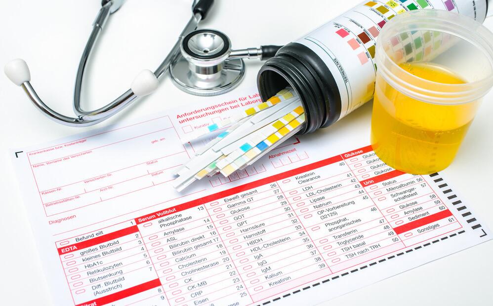 早孕试纸第二道红线很浅,检测试纸t区很浅很短的红线