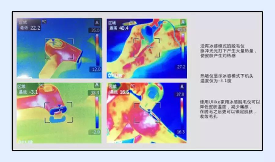 牛脱毛最快最有效的方法,土方脱毛最有效的方法