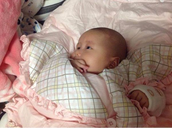 65岁如何手术矫正o型腿快速有效,孩子O型腿如何纠正