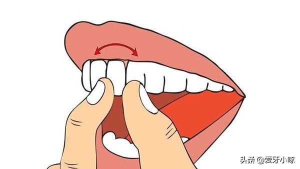 牙齿松动怎么办最有效的方法,牙齿松动怎么办教你一招搞定