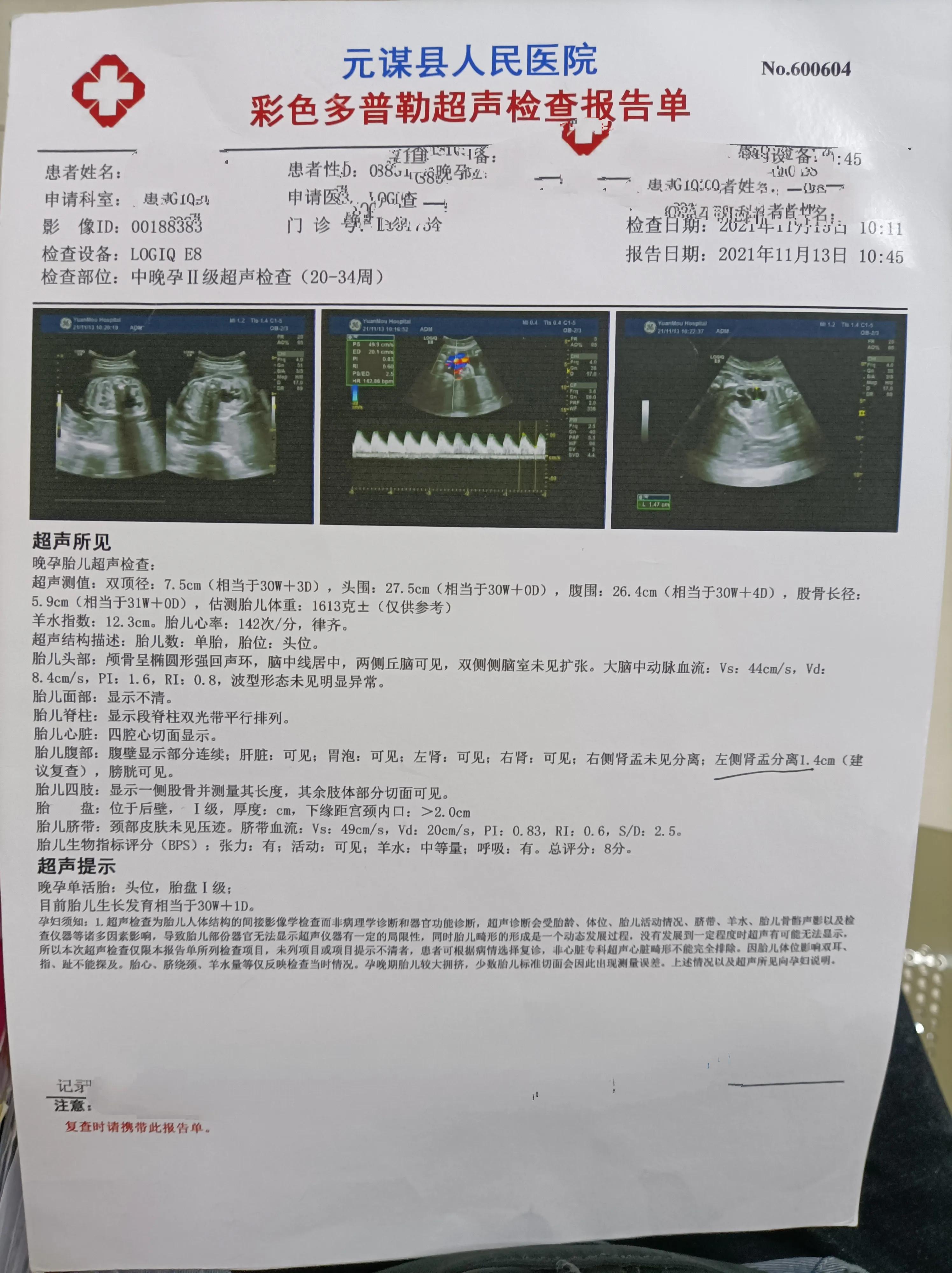 脐血穿刺的过程,脐血穿刺痛苦吗