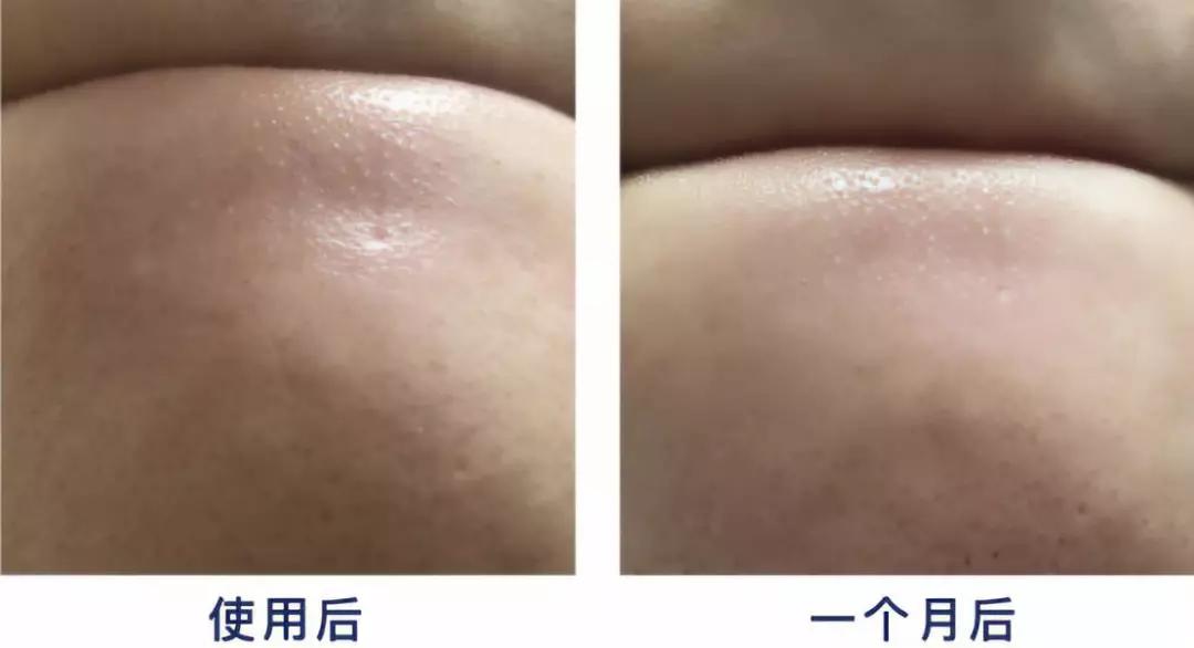 韩国超火品牌，明星都在安利，堪比CPB洗面奶！薛凯琪把它作为C位