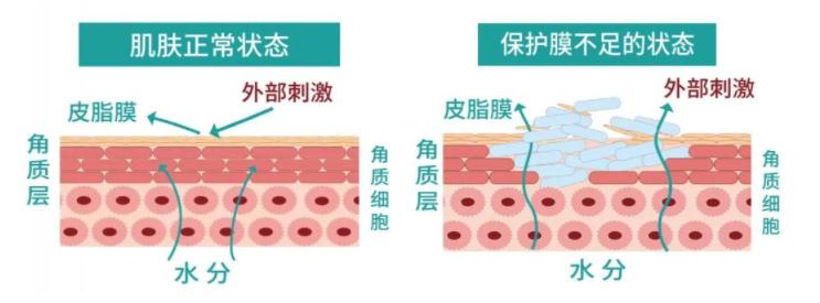 贴面膜有点小刺痛是缺水吗,脸部缺水贴面膜会刺痛是怎么回事