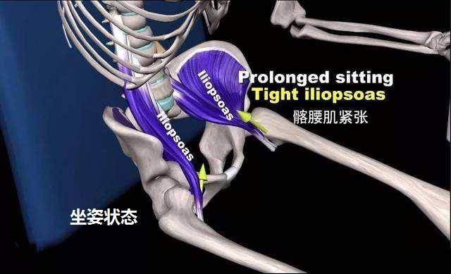 久坐腹股沟酸胀是怎么回事,久坐腹股沟疼痛的原因