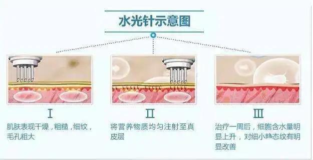 暑期变美变瘦好物推荐,暑假教你如何变美