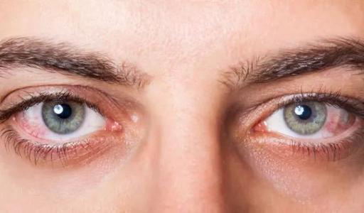 脸部出现这些症状，小心肾衰竭！