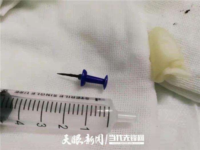 6岁小孩不小心吞了钉子怎么办,7岁儿童误吞铁珠子