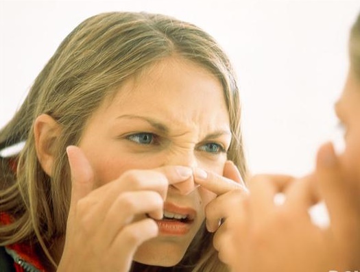 鼻子上黑头怎么去除不要钱,鼻子上的黑头怎么去除美容院