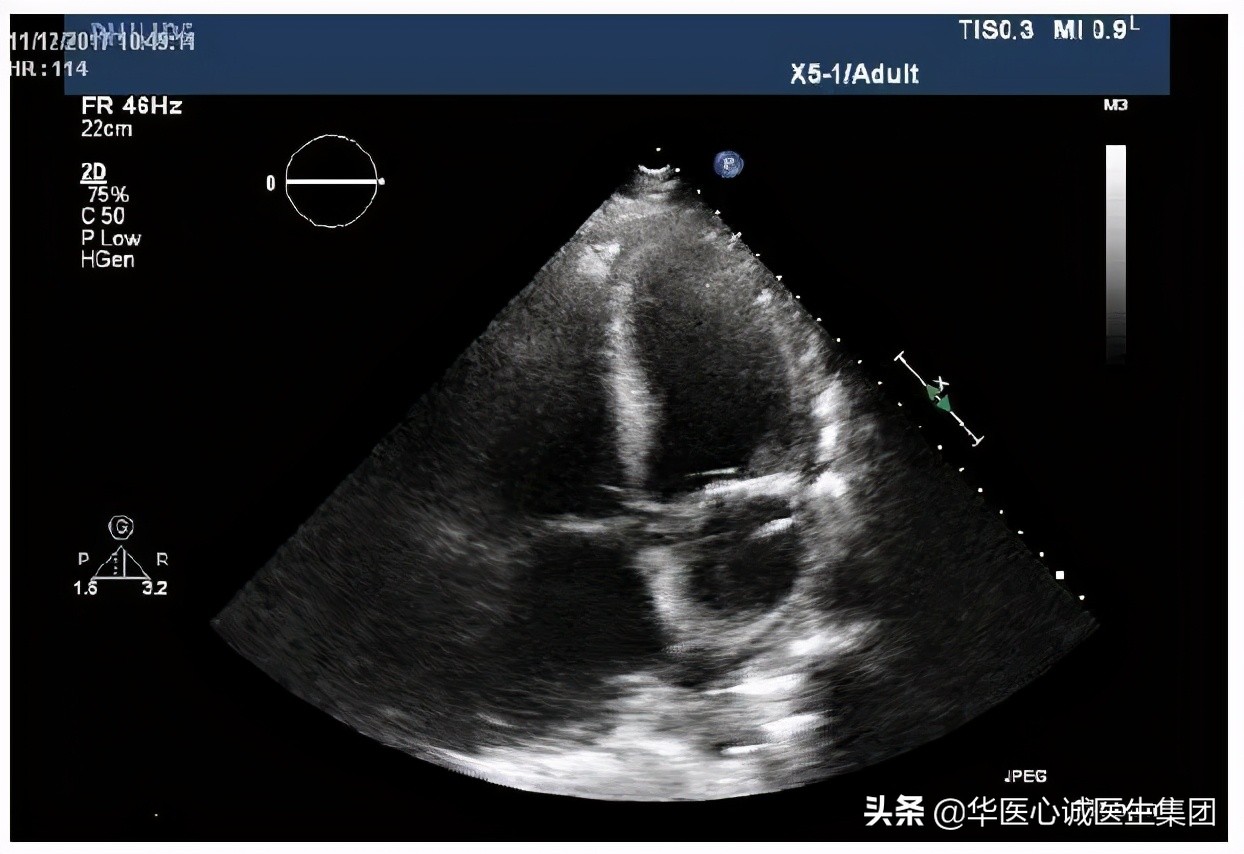 杨颖局部图,杨颖早期下颌宽大